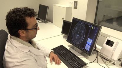 Un científico observa un cerebro en el ordenador.