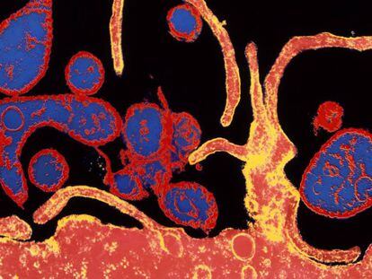 Microfotografía electrónica coloreada del virus del sarampión infectando una célula. 