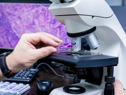 Imagen de una muestra en un laboratorio.