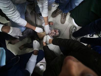 Un niño palestino herido en un ataque israelí es atendido este domingo en un hospital de Rafah, en el sur de Gaza.