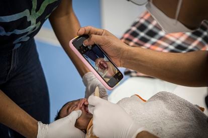 San Bartolo de Coyotepec, Oaxaca. Los médicos del hospital sobre ruedas Mobile Surgery International (MSI) toman una fotografía del paladar hendido de un recién nacido que acaba de llegar al centro de salud. En el hospital público de la capital oaxaqueña, según la familia, habían asegurado a la madre que nacería sin ningún tipo de anomalía.