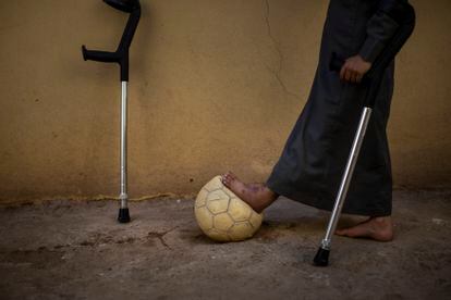 Retrato de Diab, de ocho años, en la ciudad de Faluya. Recibió el impacto de un explosivo abandonado y sufrió graves heridas en su pierna. 