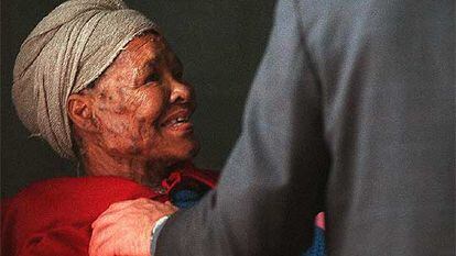 Una enferma de sida en el Catholic AIDS Care Centre, en Ciudad del Cabo.