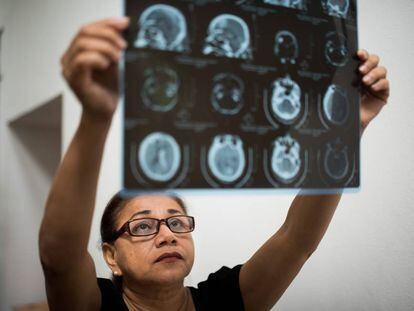 Josefa Esterlina Meza con una radiografía de su hijo, asesinado en las protestas de Nicaragua.