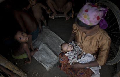 Síntomas de desnutrición en los niños de los campamentos de refugiados de Rohingya, en Myanmar.