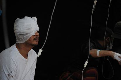 An injured person receives medical attention in Cianjur (Indonesia). 
