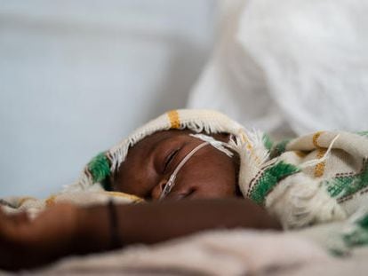 Un niño con complicaciones respiratorias en el Chad, África, a mediados de abril de 2020.