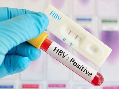 Las terapias para la hepatitis C disparan el mercado hospitalario un 28,7%