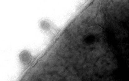 Virus fagos en la membrana de una bacteria &#039;E. coli&#039;.