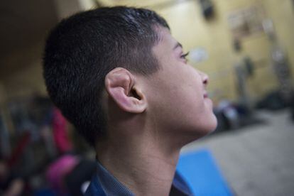 Simran Ahlaway muestra con orgullo su 'oreja de coliflor', una deformación propia de los luchadores. "Mi madre dice que es fea, pero quiere decir que me esfuerzo", dice. Tiene 13 años.