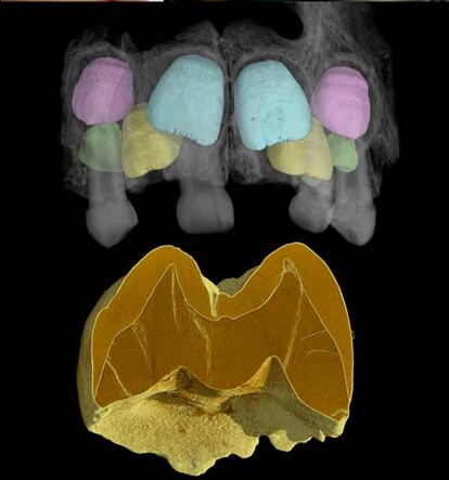Maxilar superior de un niño neandertal analizado con el sincrotrón ESRF, que permite a los científicos obtener una imagen de cada diente aislado