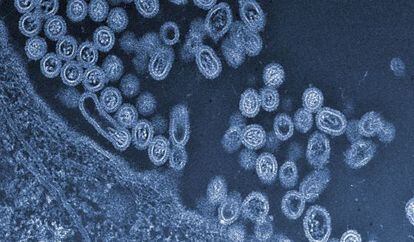 Virus de la gripe aviar H7N9 saliendo de una c&eacute;lula.
