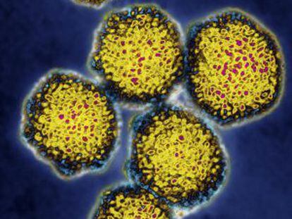 Imágenes obtenidas mediante un microscopio electrónico del virus de la hepatitis C.