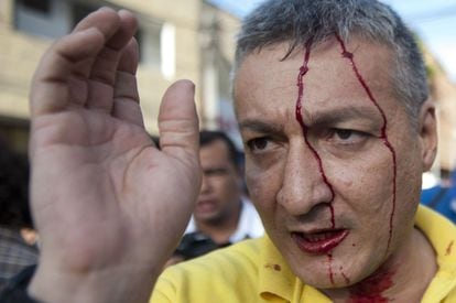 Un periodista herido este jueves en Medellín durante la intervención policial contra la manifestación agraria.