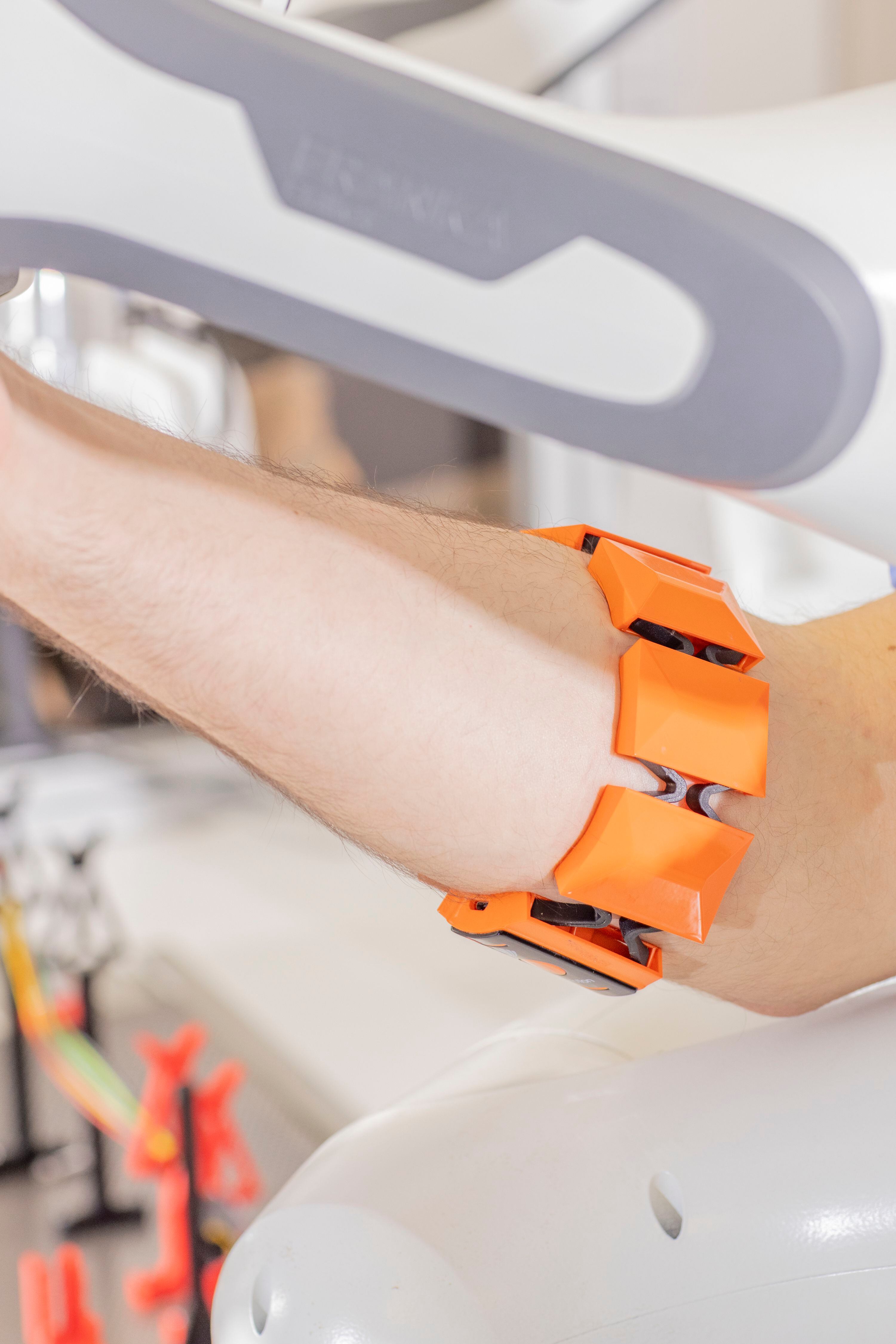 Pulsera que, por medio de sensores que envían información a la mano robótica, permite mover una prótesis leyendo los movimientos de los músculos del antebrazo.