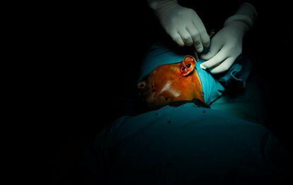 Un médico realiza la cirugía del oído medio dentro de un quirófano del Lifeline Express.