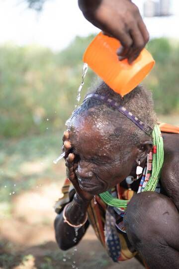 Para el tracoma una de las recomendaciones es lavarse las manos, pero también la cara.