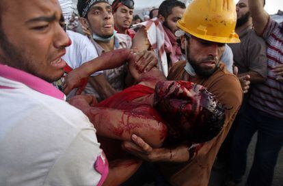Atención a uno de los heridos en los enfrentamientos con la policía en El Cairo.