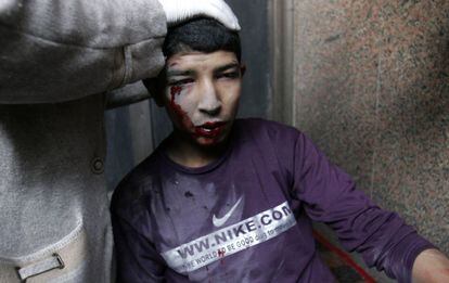 Un manifestante, herido durante las protestas, recibe atención médica cerca de la Plaza de la Liberación.