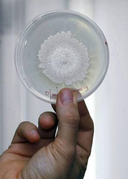 En la imagen, vista de un cultivo de hongos pertenecientes a una investigación del Departamento de Fitopatología de la Facultad de Ciencias de la Universidad de Alicante.