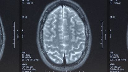 Imagen médica de la sección de un cerebro.