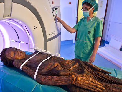 La momia guanche del Arqueológico Nacional sometida a una tomografía axial computarizada en el Hospital Quirón de Madrid.