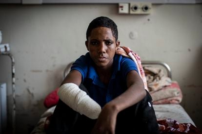 Haftom Gebretsadik, adolescente de 17 años de Freweini (Etiopía), perdió su mano izquierda en un ataque de artillería en marzo. Posa en el hospital Ayder Referral de Mekele el 6 de abril.