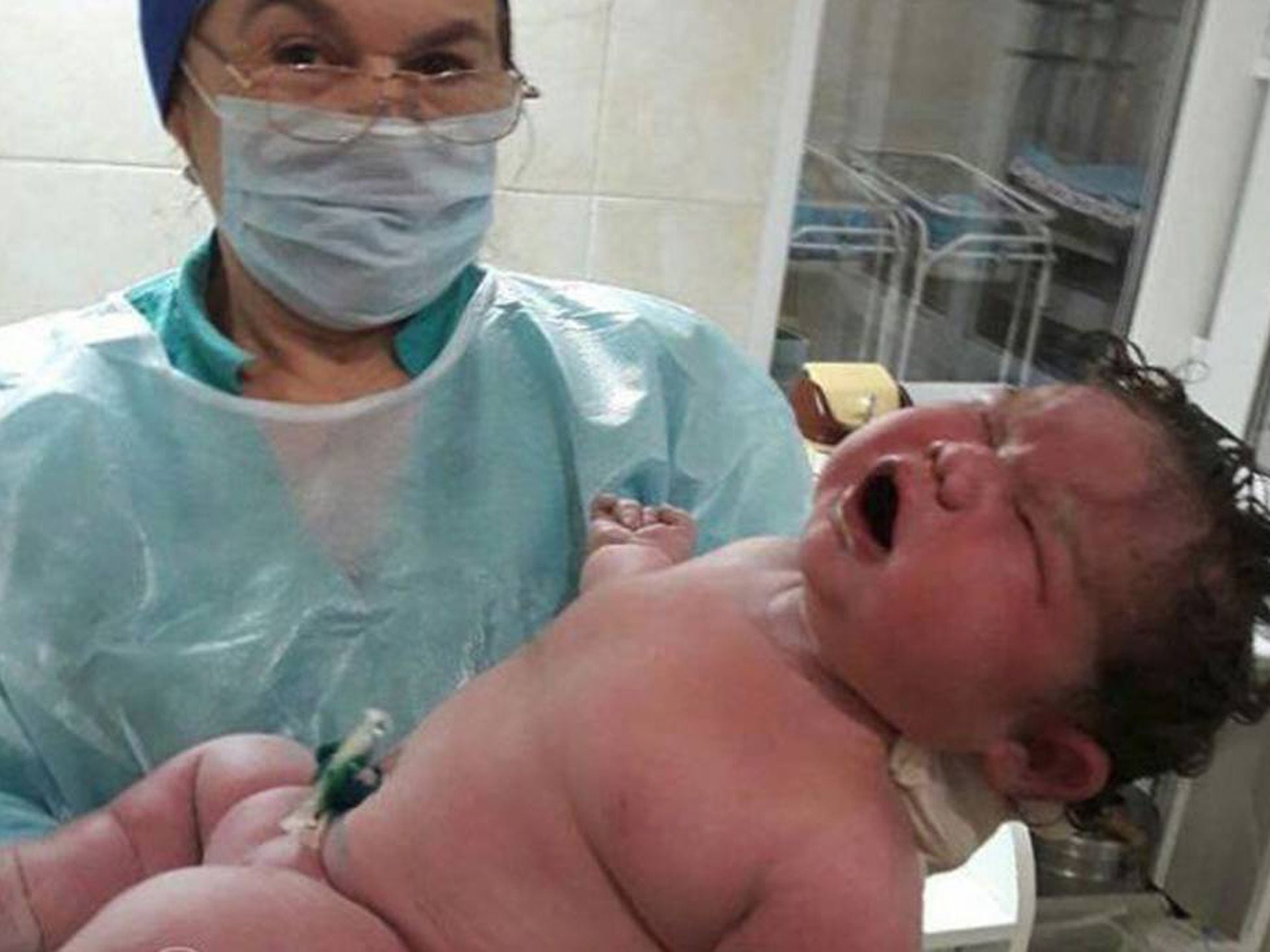 Medicina é - O maior bebê nascido por parto natural, pesando  aproximadamente 7,9kg e 57,5 cm de comprimento !! Os médicos achavam que o  bebê ia ser GIG, então montaram uma equipe