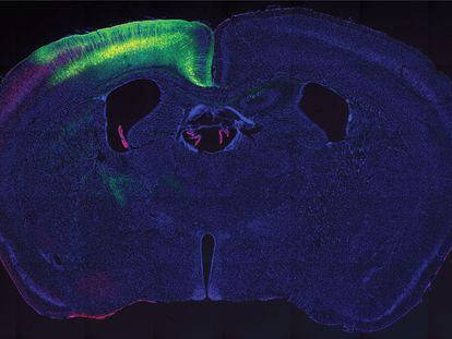 La imagen muestra una sección del cerebro de uno de los ratones del ensayo. En verde, la región del córtex activada por los ultrasonidos tras introducirle proteínas 'sonosensibles'.