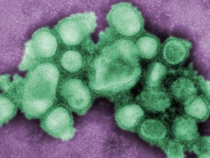 Virus de la gripe porcina H1N1.