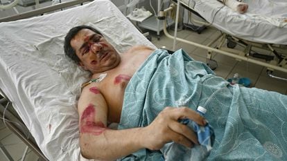 Un hombre se recupera de las heridas tras el bombardeo en Kremenchuk.