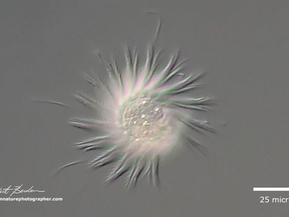 La 'Halteria sp', aquí vista al microscopio, es un protista ciliado (esos hilos como pestañas) que se mueve por espasmos al ritmo de 100 por segundo.