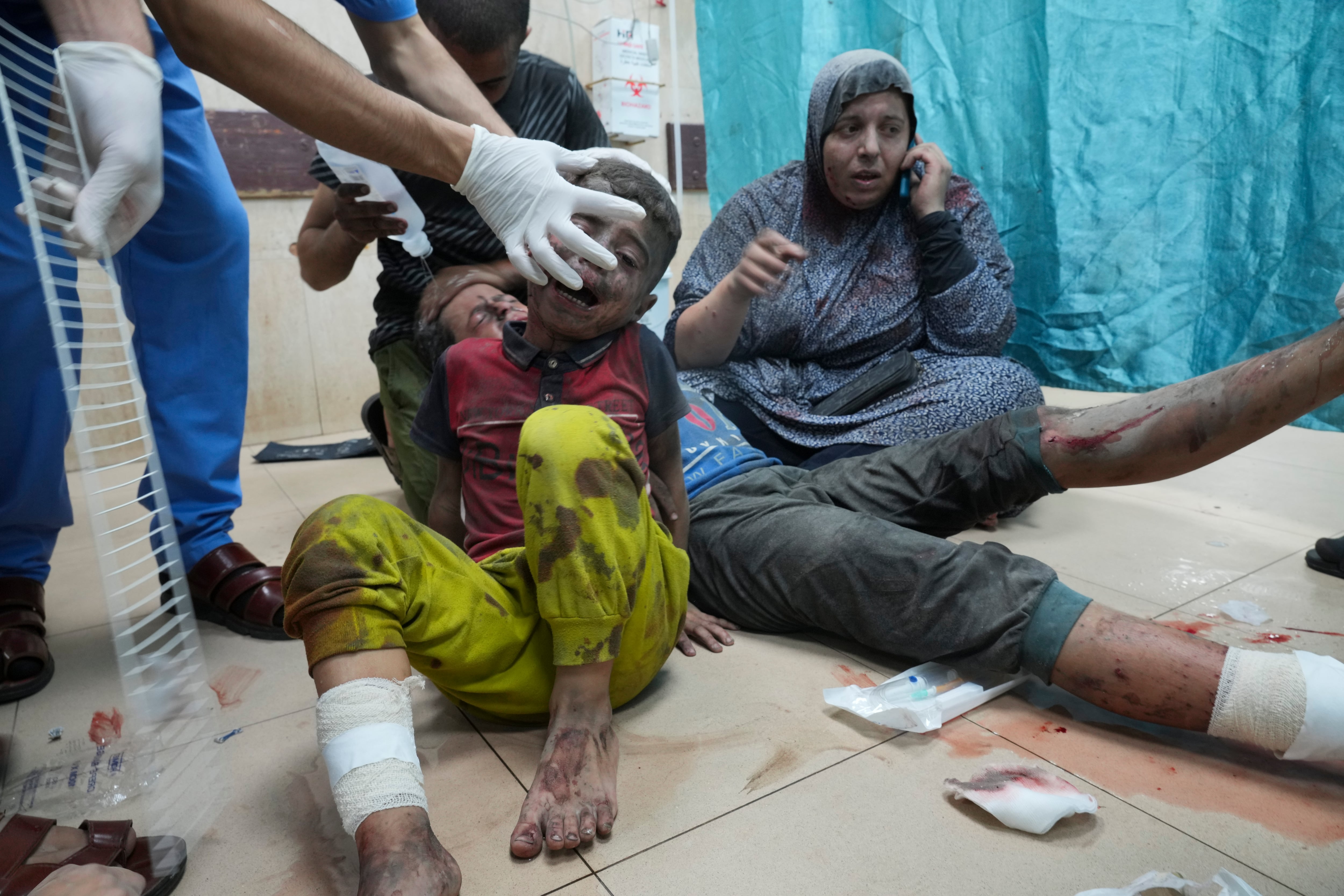 Varios palestinos heridos en un bombardeo israelí, este martes en un hospital en Deir al-Balah, en el sur de Gaza.