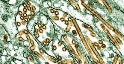 Micrograf&iacute;a del virus H5N1 (color dorado) en un cultivo de c&eacute;lulas (verde).