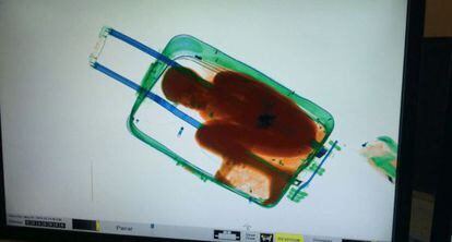 Imatge de l'escàner que mostra el menor a la maleta.