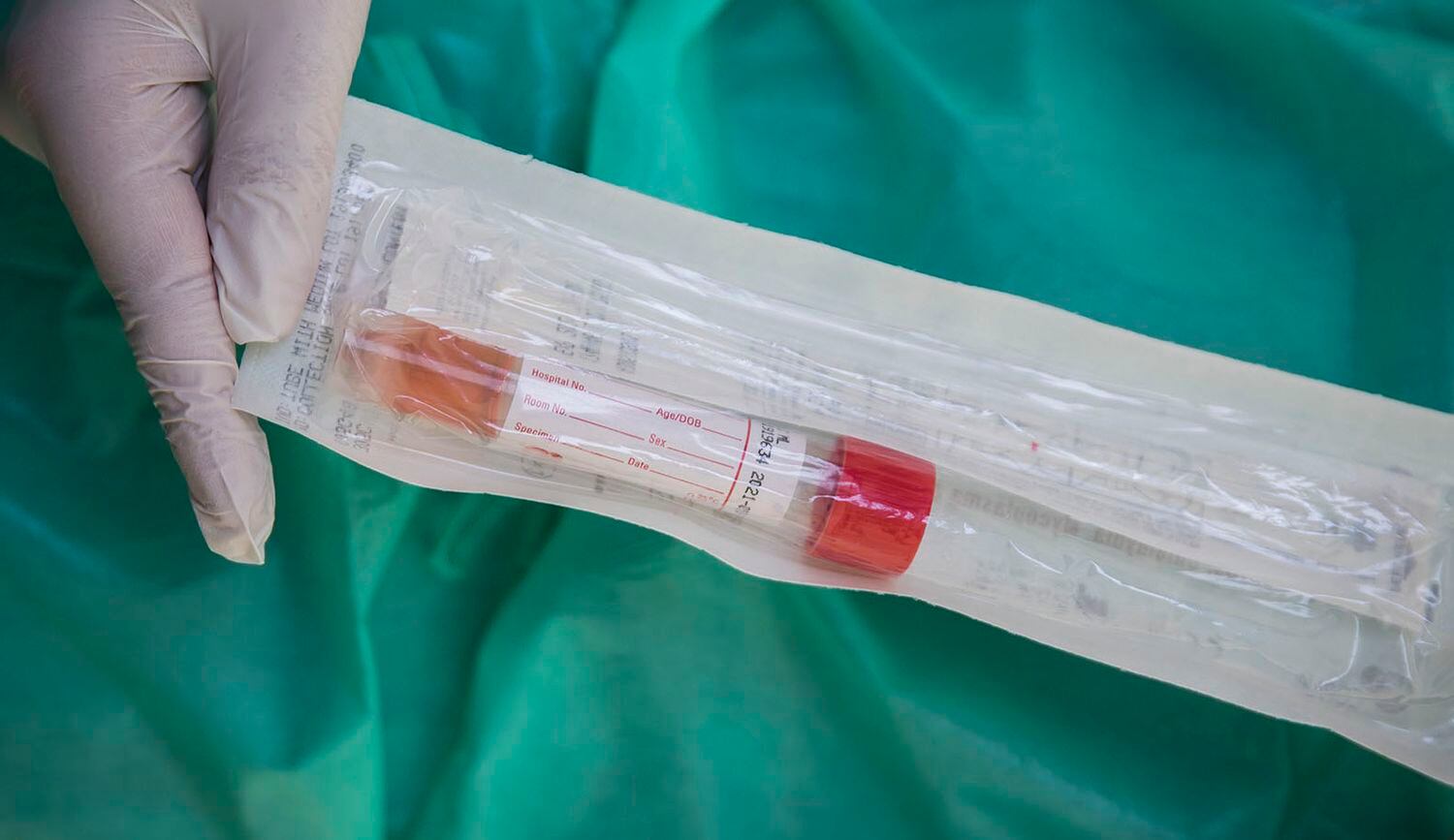 El Complejo Hospitalario Universitario de A Coruña (CHUAC) ha implantado el 'covidauto' para realizar pruebas del coronavirus a los pacientes desde sus propios vehículos sin que tengan que bajarse de ellos.