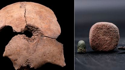 A la izquierda, el cráneo del niño con el orificio de una bala. A la derecha bala, goma de borraz y restos de un lápiz.