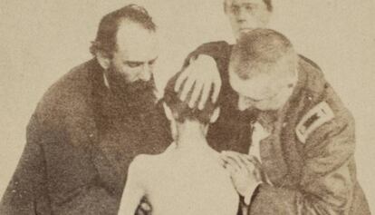 Un soldado de la Unión, tras ser liberado de una prisión confederada.
