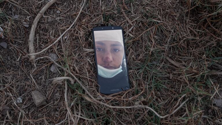 La última foto de Joys Estefani Qqueccaño Huamani (24 años) antes de su desaparición el 9 de octubre 2020. En la imagen, Joys Estefani tiene el rostro contusionado y la cabeza vendada después de haber sido agredida por su expareja y padre de sus dos hijas en septiembre. Ella envió esta foto a su hermano Percy. Distrito de Pampamarca, Provincia de Canas, Cuzco.