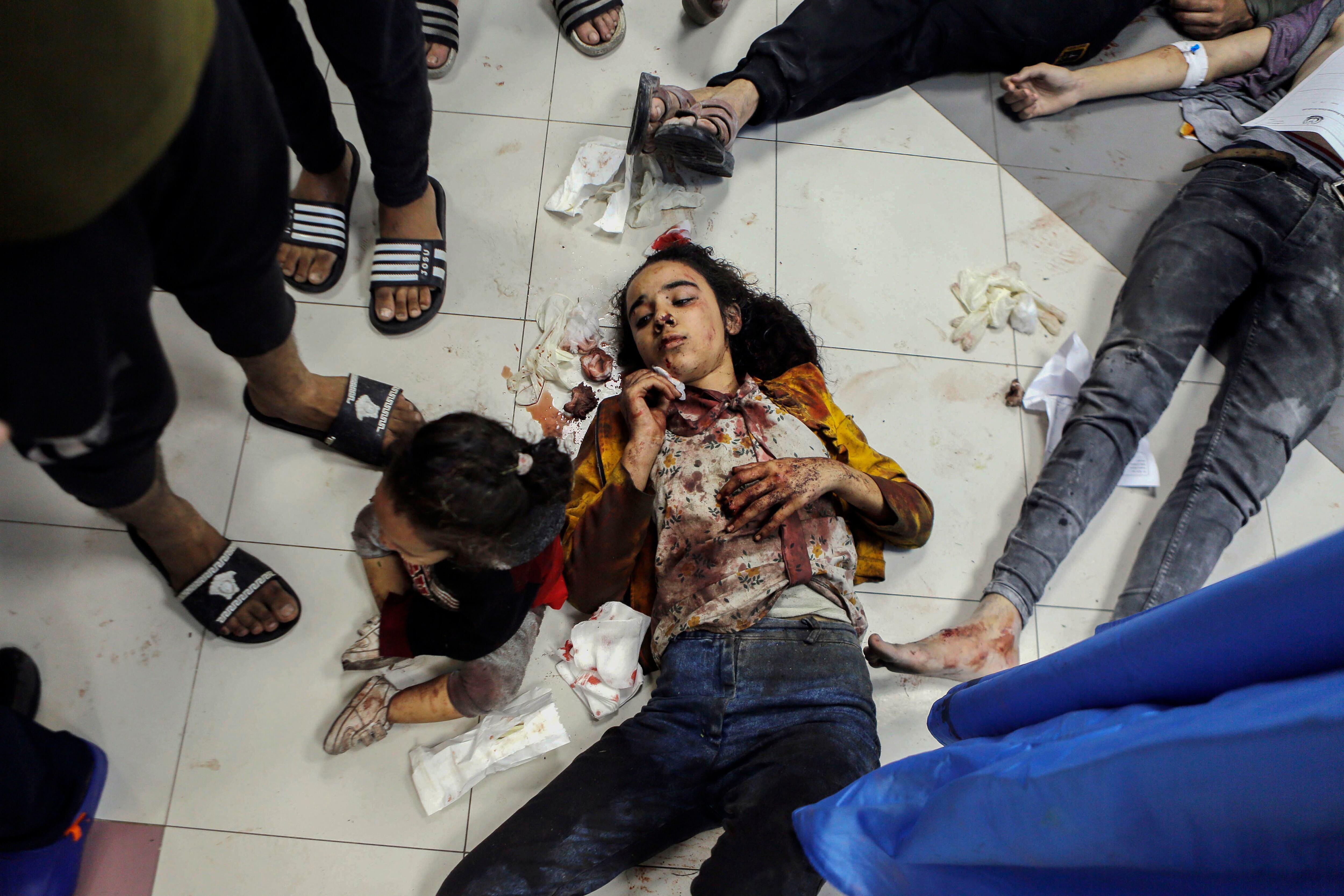 Varios heridos esperaban recibir atención médica en el hospital Al Shifa de la franja de Gaza. 