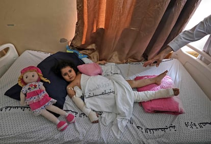 Una niña palestina herida en un bombardeo israelí, el día 19 en el hospital Shifa de Gaza.