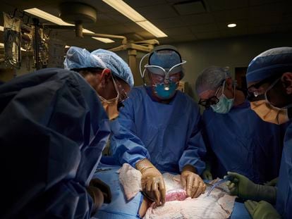 Cirujanos de un hospital de Nueva York examinan el posible rechazo de un riñón de cerdo en un paciente, en septiembre de 2021.