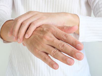 La artritis psoriásica afecta a 215.000 personas en España, según la Sociedad Española de Reumatología (SER).