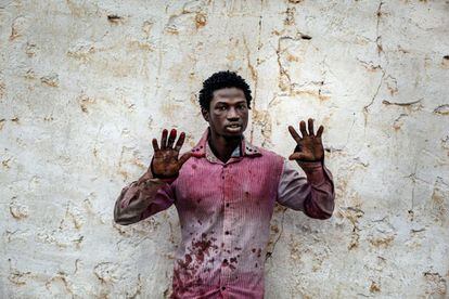 Abdourahman Giallo, de 23 anys i de Guinea Conakry, mostra les ferides després d'intentar saltar la tanca que separa Melilla del Marroc el 15 de gener del 2014.
