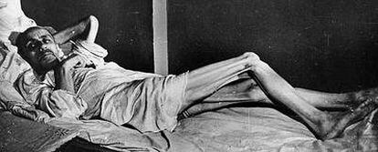Una víctima de las hambrunas padecidas en Ucrania yace en una cama, en una imagen tomada en 1935 y usada por la propaganda alemana cinco años después.