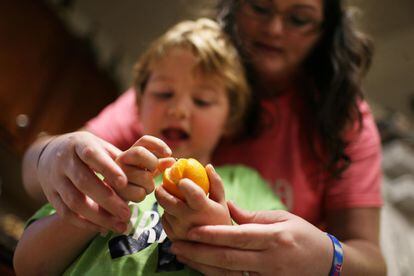 Un niño con leucodistrofia metacromática intenta pelar una mandarina con ayuda de su madre en su casa en Payson, Illinois (EE UU).