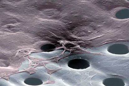 Células de la piel crecen sobre el material perforado HYAFF (abajo), de 20 micras de espesor, para regenerar la epidermis.