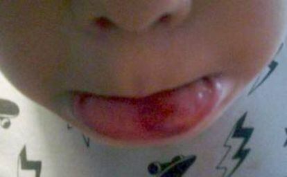 J. T. muestra la herida en la boca tras la paliza recibida.