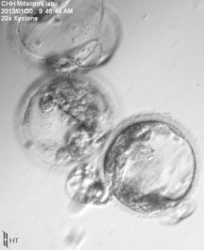 Células madre embrionarias obtenidas por los investigadores.