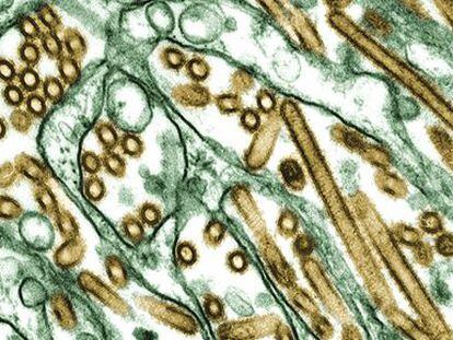 Micrograf&iacute;a del virus H5N1 (color dorado) en un cultivo de c&eacute;lulas (verde).